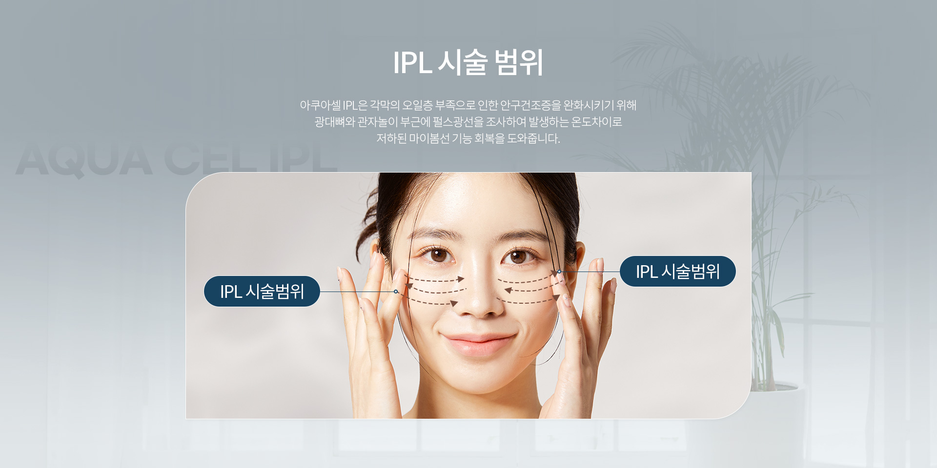 IPL 건조증 클리닉_05