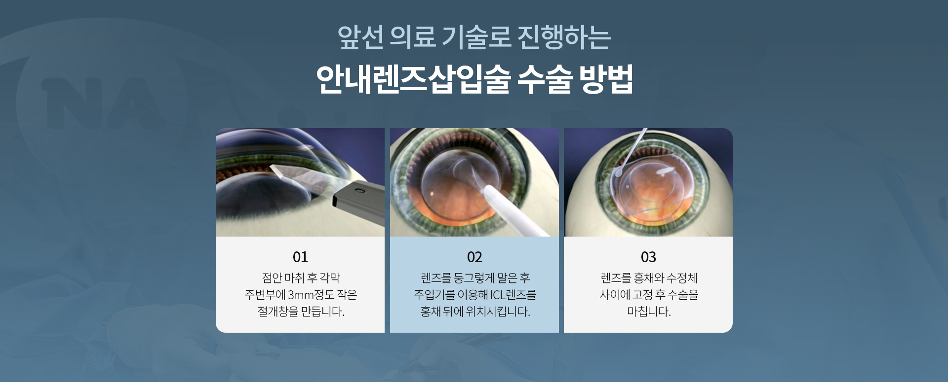 안내렌즈삽입술_02