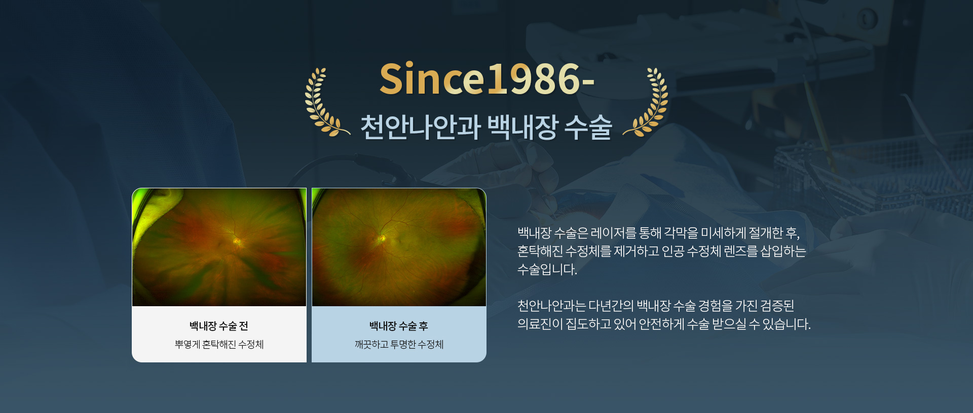 백내장_01