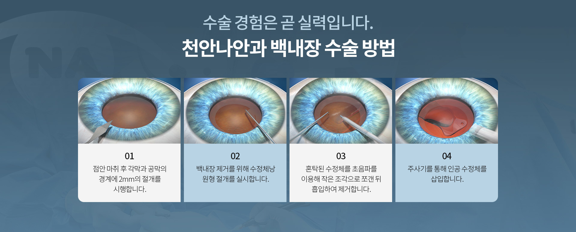 백내장_02