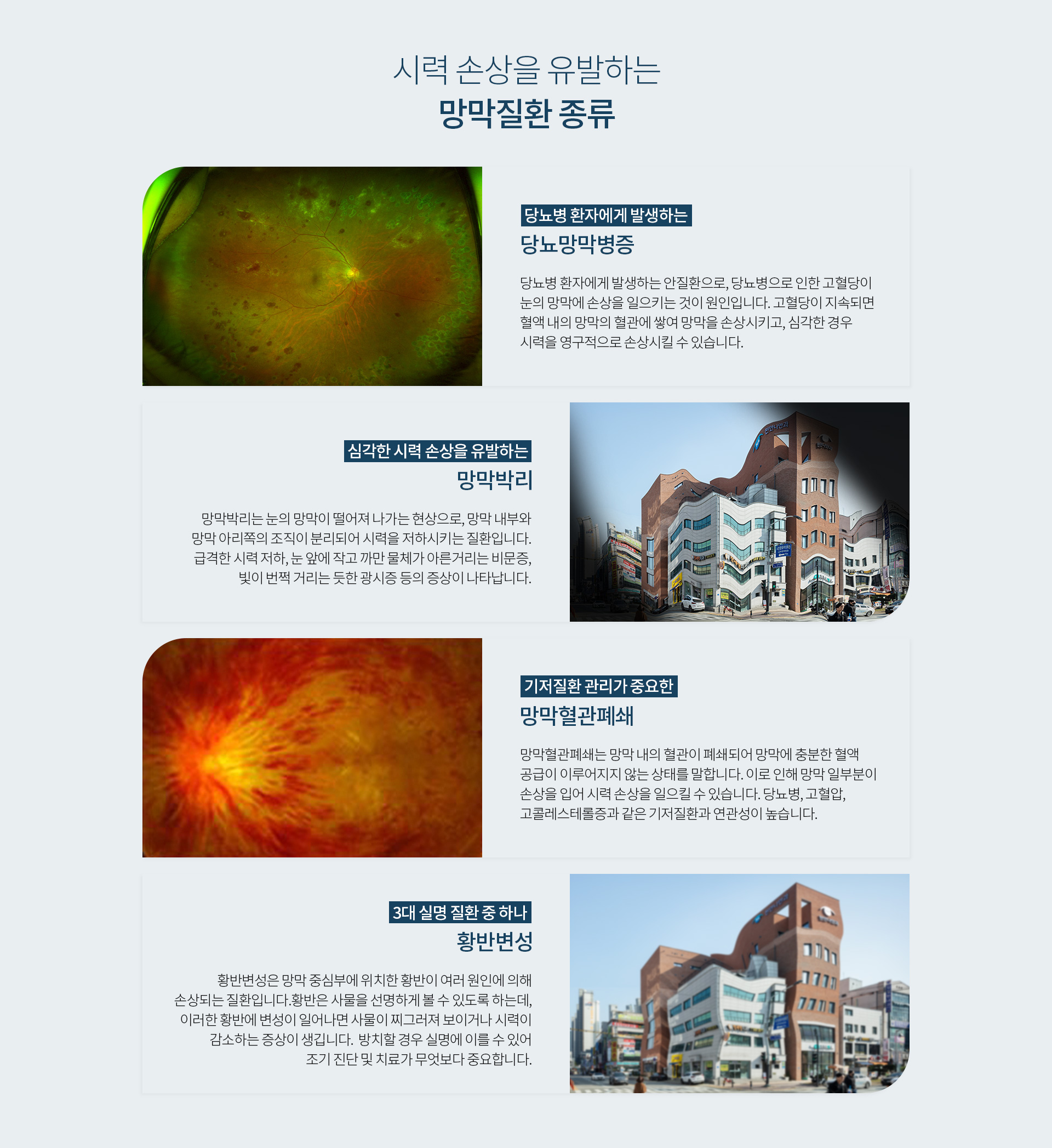 망막질환_01