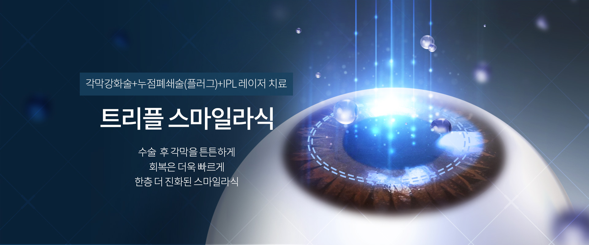 트리플 스마일라식_키비주얼