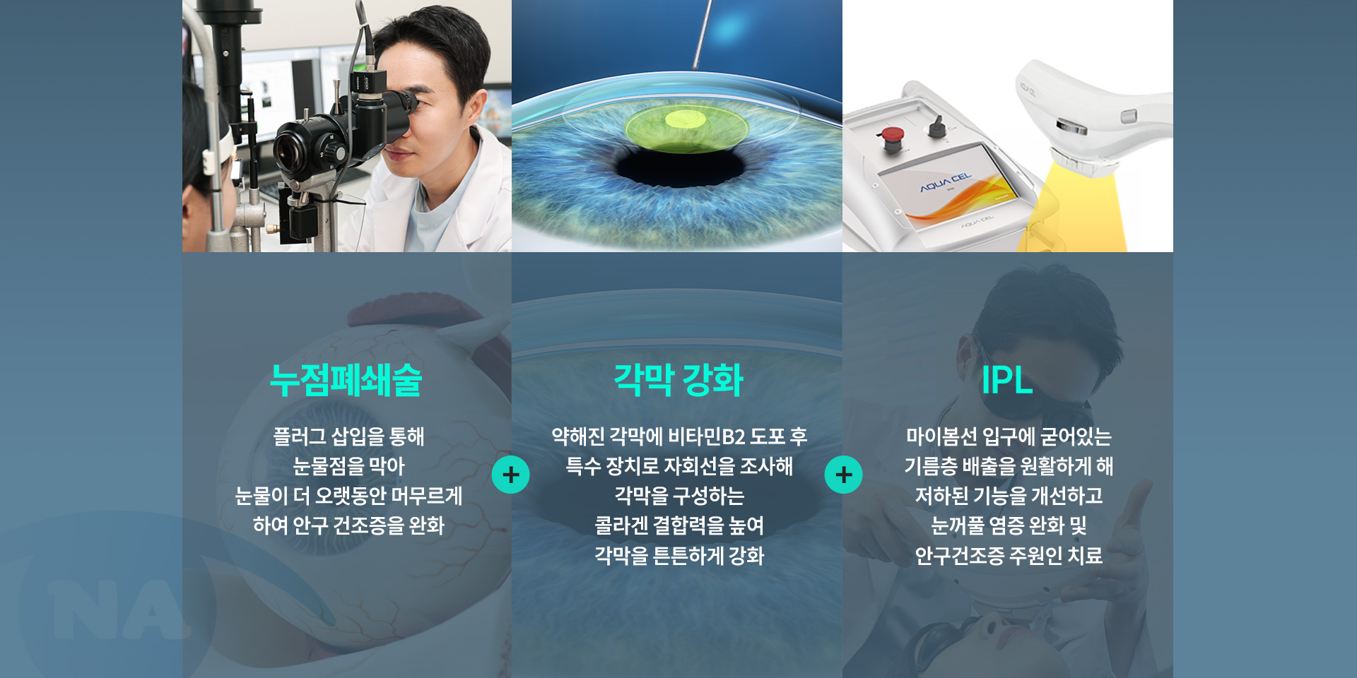 트리플 스마일라식_02